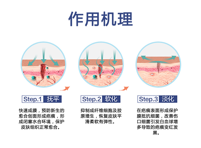 解开疤痕贴之谜，还你自信的美丽！[888集团电子游戏官方网站医疗]